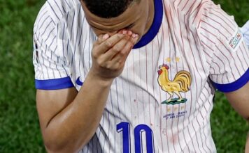 ‘Any ideas for a mask?’ Mbappe seeks advice from rugby captain Dupont after breaking nose