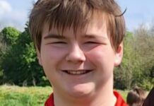 Teen Rugby Player Died One Day After Grazing Leg During Match